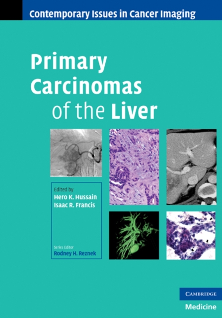 Primary Carcinomas of the Liver, EPUB eBook
