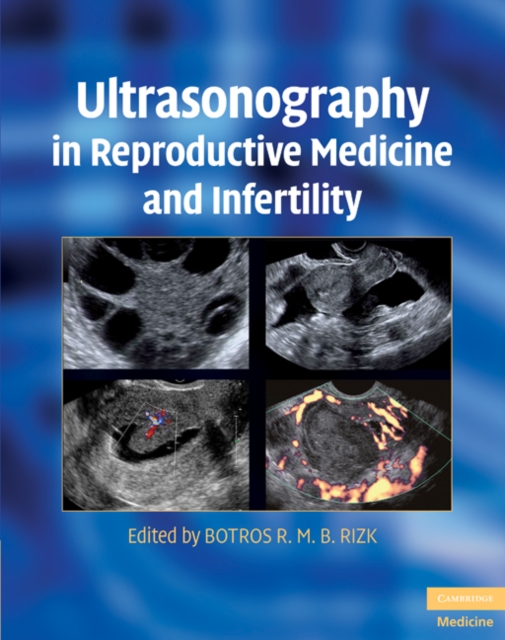 Ultrasonography in Reproductive Medicine and Infertility, EPUB eBook