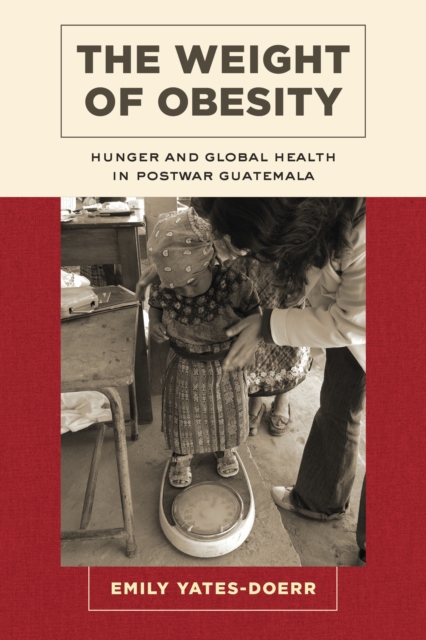 The Weight of Obesity : Hunger and Global Health in Postwar Guatemala, EPUB eBook