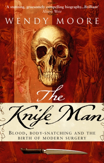 The Knife Man, Paperback / softback Book