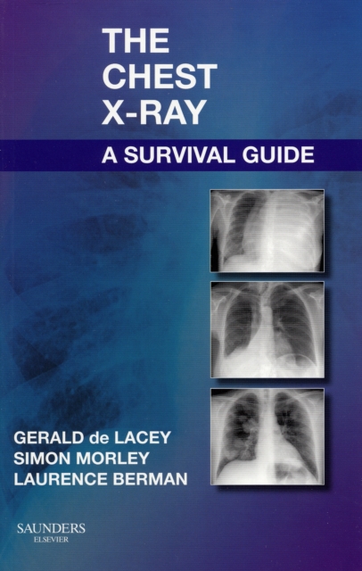 The Chest X-Ray: A Survival Guide, Paperback / softback Book