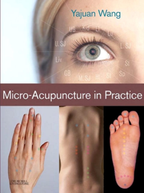 Micro-Acupuncture in Practice, EPUB eBook