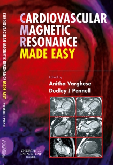 Cardiovascular Magnetic Resonance Made Easy, EPUB eBook