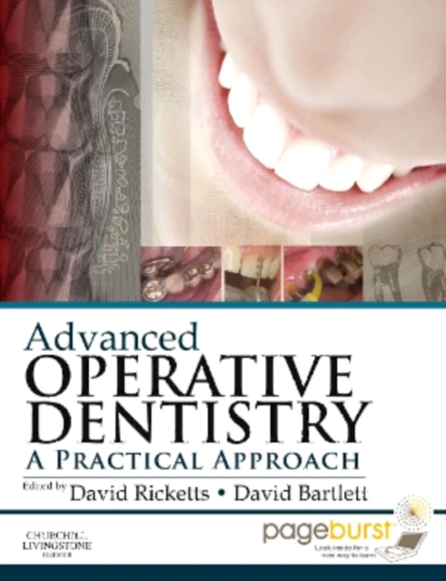Advanced Operative Dentistry : A Practical Approach, EPUB eBook