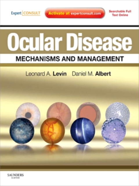 Ocular Disease: Mechanisms and Management : Expert Consult - Online and Print, EPUB eBook