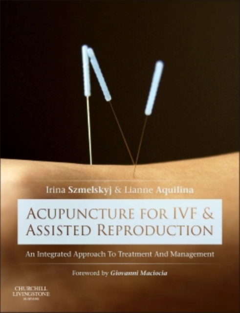 Acupuncture for IVF and Assisted Reproduction : An integrated approach to treatment and management, Hardback Book