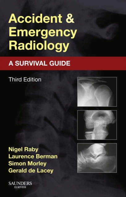 Accident and Emergency Radiology: A Survival Guide, EPUB eBook
