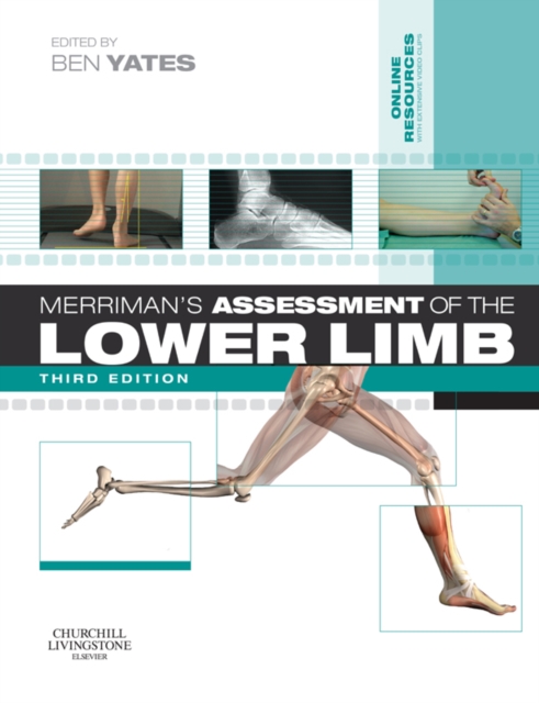 Merriman's Assessment of the Lower Limb E-Book : Merriman's Assessment of the Lower Limb E-Book, EPUB eBook