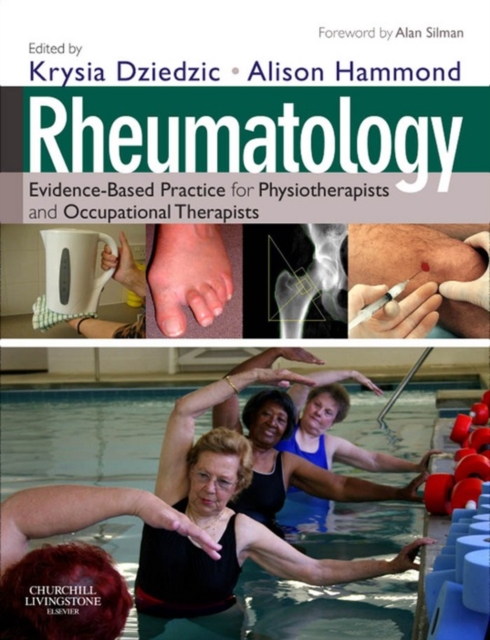 Rheumatology E-Book : Rheumatology E-Book, EPUB eBook