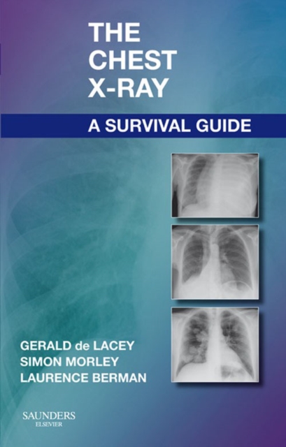 The Chest X-Ray: A Survival Guide, EPUB eBook