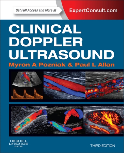 Clinical Doppler Ultrasound : Expert Consult: Online, EPUB eBook