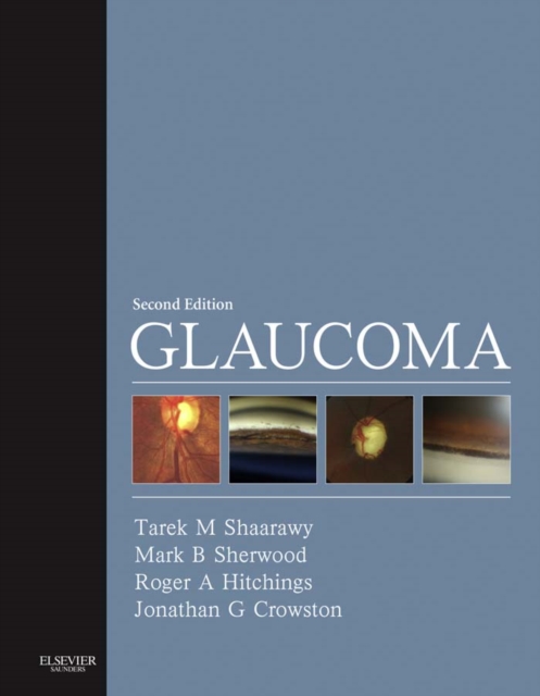 Glaucoma E-Book, EPUB eBook