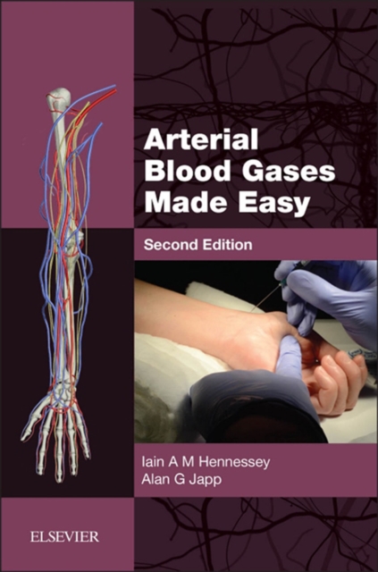 Arterial Blood Gases Made Easy E-Book : Arterial Blood Gases Made Easy E-Book, EPUB eBook