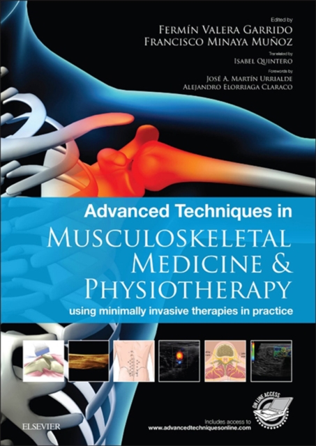 Advanced Techniques in Musculoskeletal Medicine & Physiotherapy - E-Book : Advanced Techniques in Musculoskeletal Medicine & Physiotherapy - E-Book, EPUB eBook