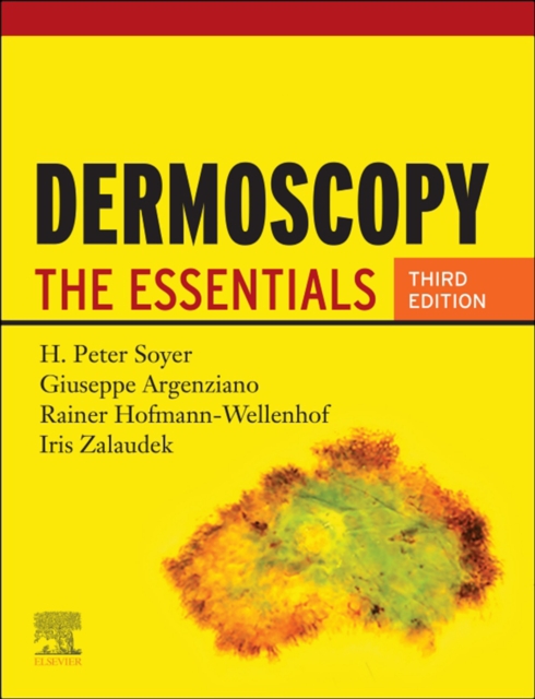 Dermoscopy E-Book : The Essentials, EPUB eBook