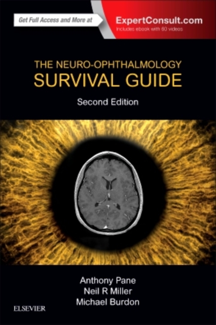 The Neuro-Ophthalmology Survival Guide, Paperback / softback Book