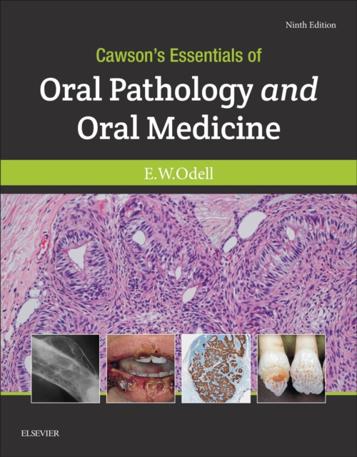 Cawson's Essentials of Oral Pathology and Oral Medicine E-Book : Cawson's Essentials of Oral Pathology and Oral Medicine E-Book, EPUB eBook