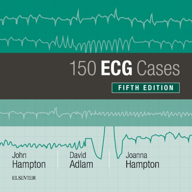 150 ECG Cases, EPUB eBook
