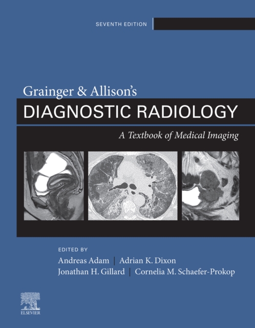 Grainger & Allison's Diagnostic Radiology, 2 Volume Set E-Book, EPUB eBook
