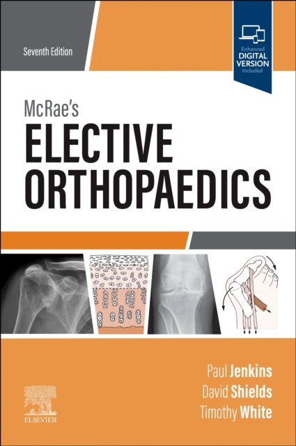 McRae's Elective Orthopaedics E-Book : McRae's Elective Orthopaedics E-Book, PDF eBook