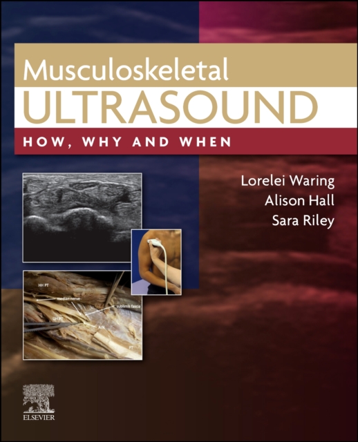 Musculoskeletal Ultrasound : How, Why and When, Hardback Book
