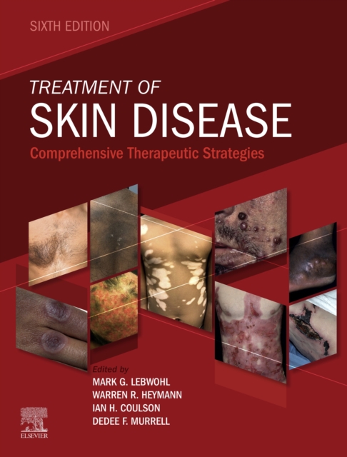 Treatment of Skin Disease E-Book : Comprehensive Therapeutic Strategies, EPUB eBook