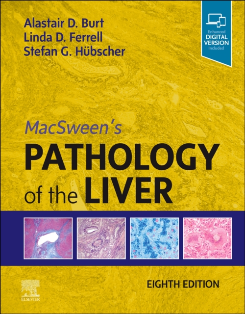 MacSween's Pathology of the Liver, E-Book, EPUB eBook