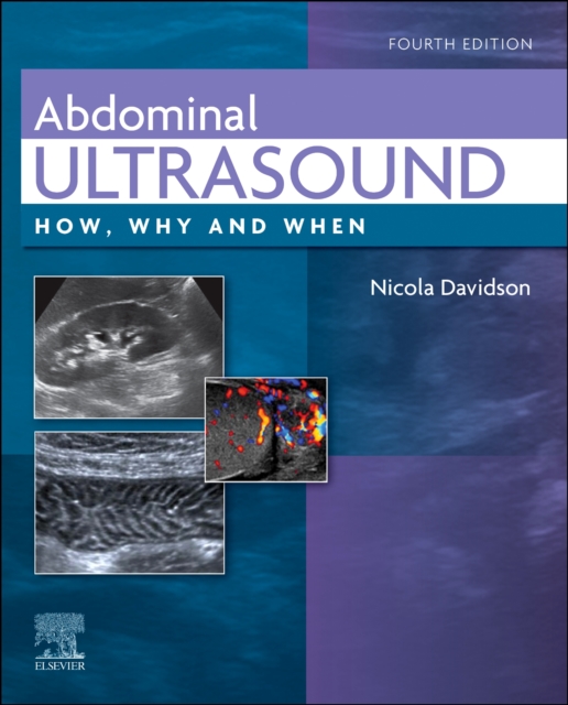 Abdominal Ultrasound : How, Why and When, Hardback Book