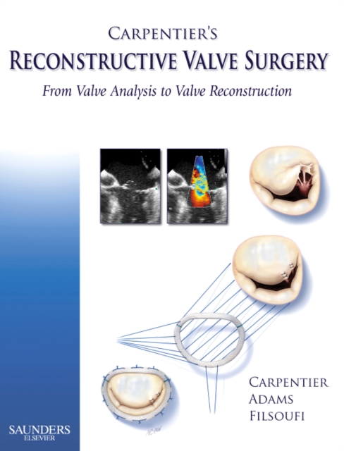 Carpentier's Reconstructive Valve Surgery, Hardback Book