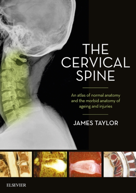 The Cervical Spine : An atlas of normal anatomy and the morbid anatomy of ageing and injuries, EPUB eBook