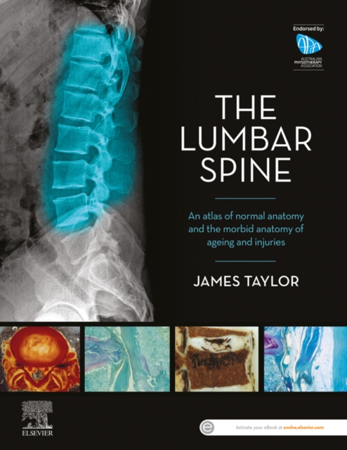 The Lumbar Spine : An Atlas of Normal Anatomy and the Morbid Anatomy of Ageing and Injury, EPUB eBook