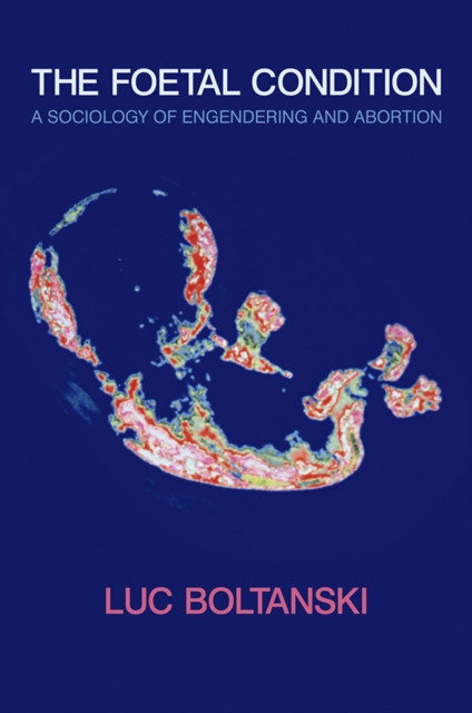 The Foetal Condition : A Sociology of Engendering and Abortion, EPUB eBook