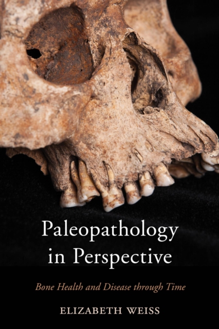 Paleopathology in Perspective : Bone Health and Disease through Time, EPUB eBook