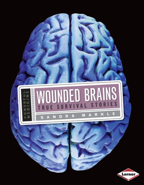 Wounded Brains : True Survival Stories, PDF eBook