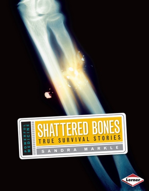 Shattered Bones : True Survival Stories, PDF eBook