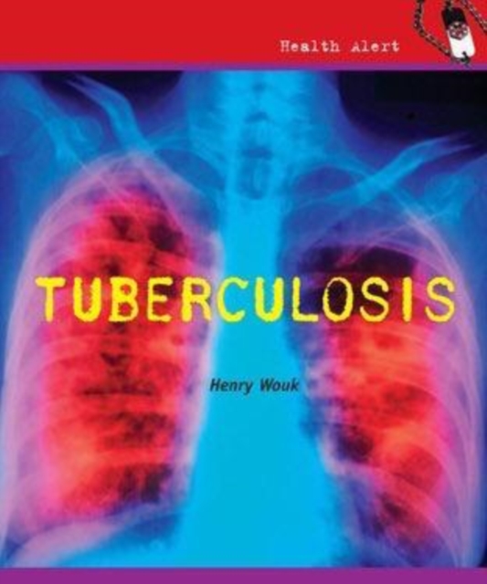 Tuberculosis, PDF eBook