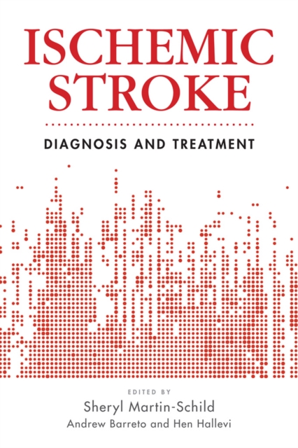 Ischemic Stroke : Diagnosis and Treatment, EPUB eBook