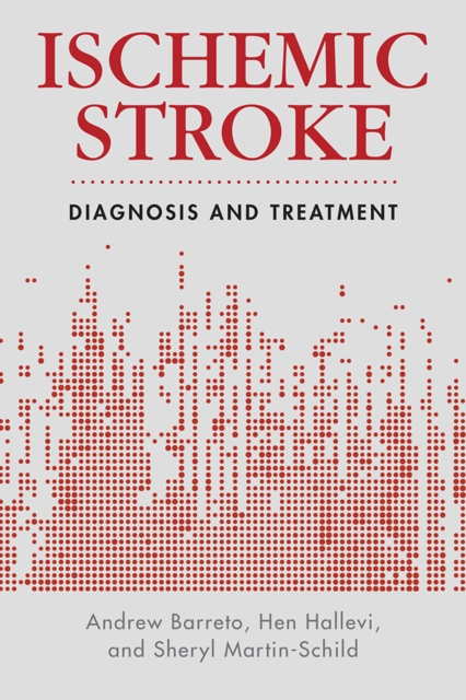 Ischemic Stroke : Diagnosis and Treatment, EPUB eBook