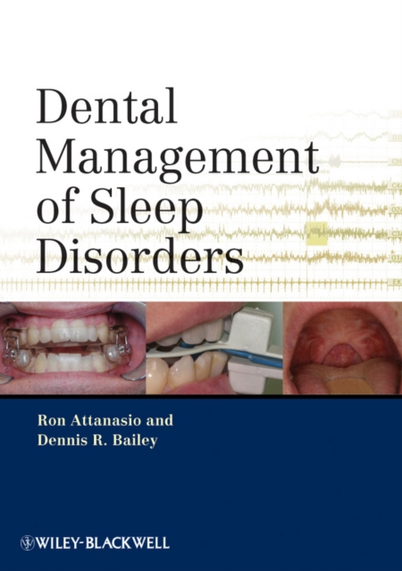 Dental Management of Sleep Disorders, PDF eBook