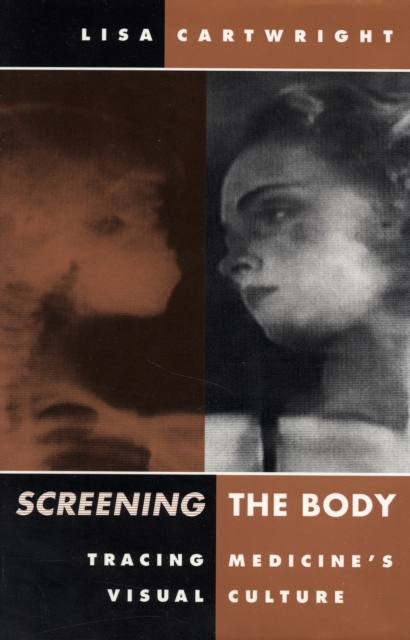 Screening The Body : Tracing Medicine’s Visual Culture, Paperback / softback Book