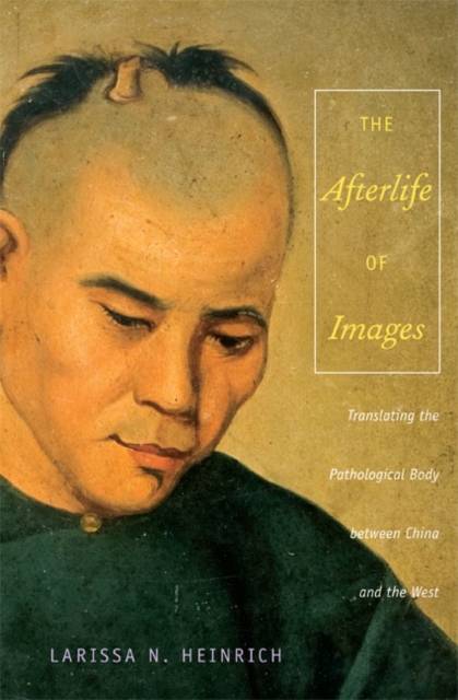 The Afterlife of Images : Translating the Pathological Body between China and the West, Hardback Book
