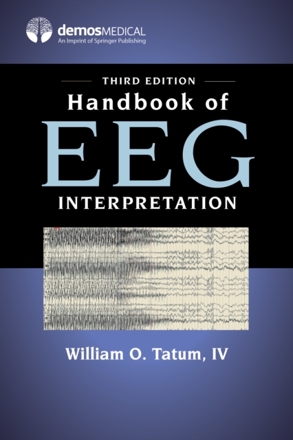 Handbook of EEG Interpretation, EPUB eBook