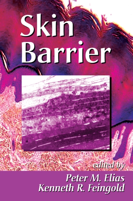Skin Barrier, PDF eBook