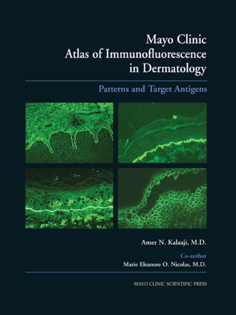 Mayo Clinic Atlas of Immunofluorescence in Dermatology : Patterns and Target Antigens, PDF eBook