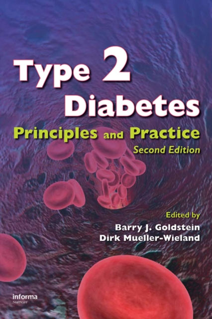 Type 2 Diabetes : Principles and Practice, Second Edition, PDF eBook