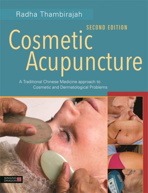 Cosmetic Acupuncture, Second Edition : A Traditional Chinese Medicine Approach to Cosmetic and Dermatological Problems, EPUB eBook