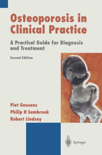 Osteoporosis in Clinical Practice : A Practical Guide for Diagnosis and Treatment, PDF eBook