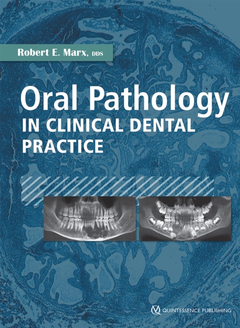 Oral Pathology in Clinical Dental Practice, EPUB eBook