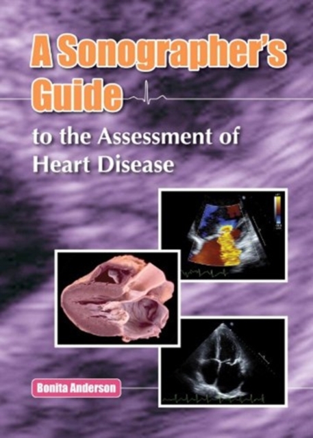 A Sonographers Guide to the Assessment of Heart Disease, Hardback Book