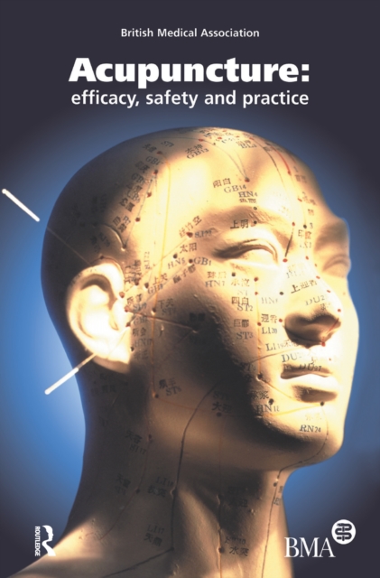 Acupuncture : Efficacy, Safety and Practice, PDF eBook
